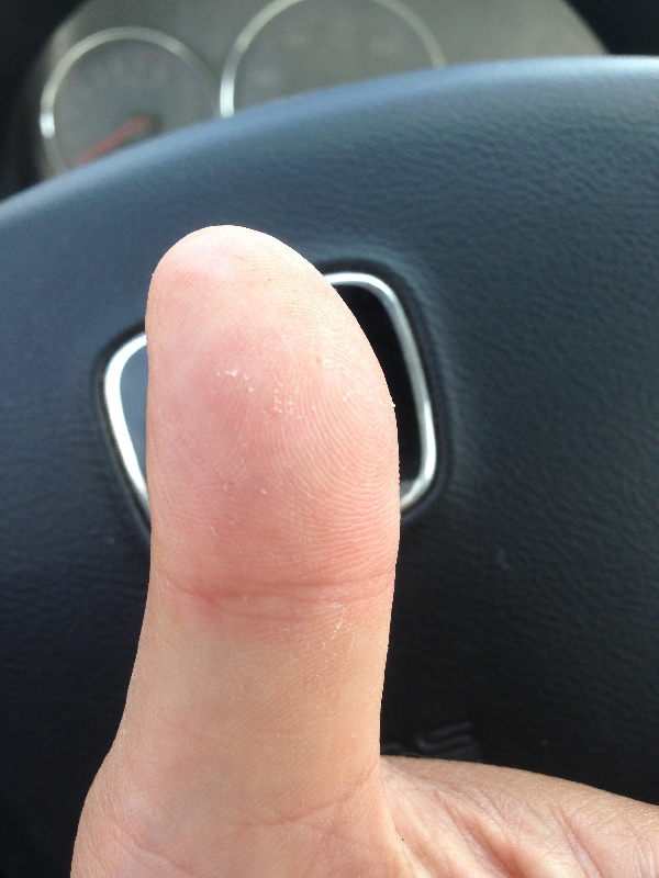 Bass Thumb!